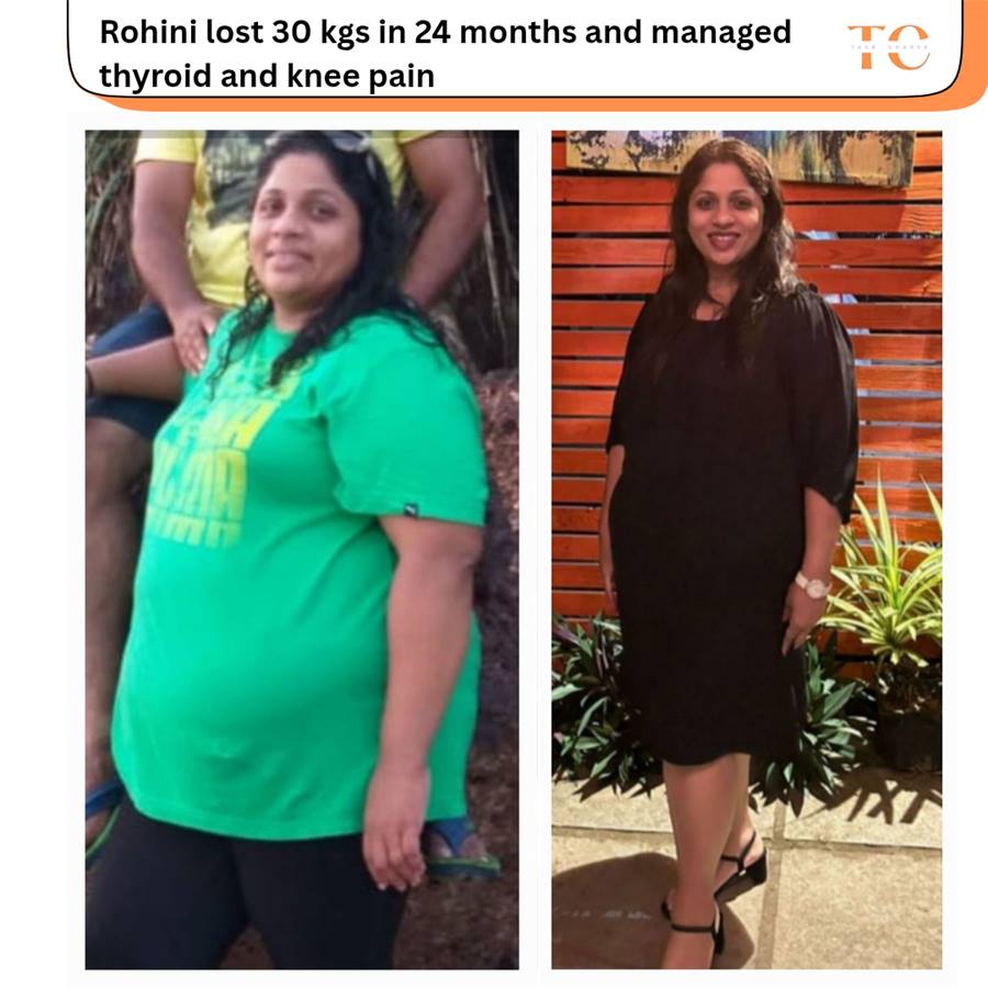 Sohini — before and after transformation