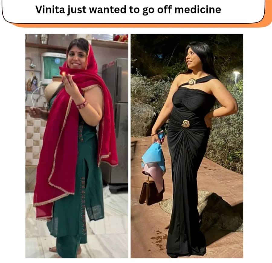 Vineeta — before and after transformation